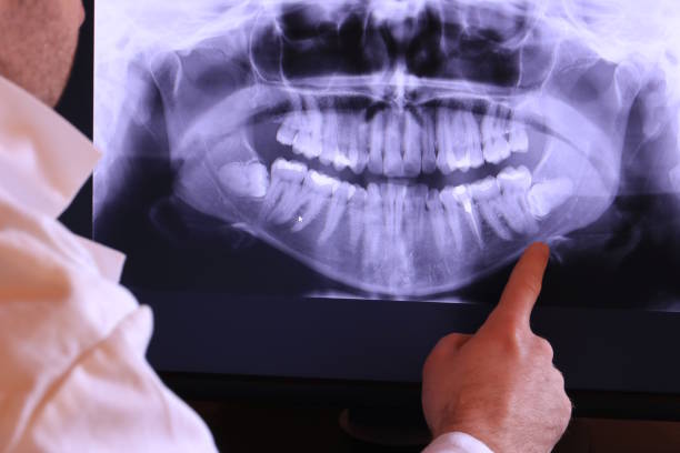 Best Emergency Tooth Extraction in Oak Point, TX