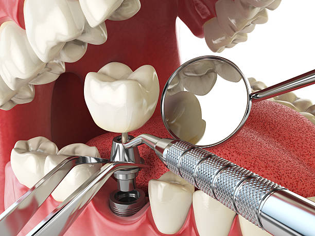 Best Emergency Gum Treatment in Oak Point, TX